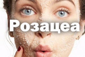 Стероидная розацеа: лечение