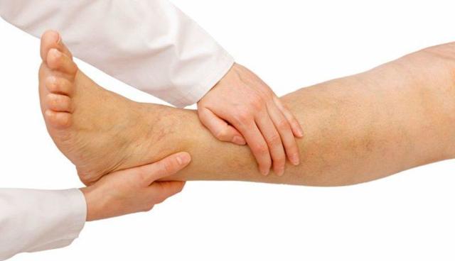 Таблетки от варикоза: венотонизирующие препараты, дезагреганты, лекарства для разжижения крови, профилактические средства, отзывы