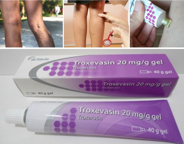 Троксевазин и тромблесс: что лучше и в чем разница (отличие составов, отзывы врачей)