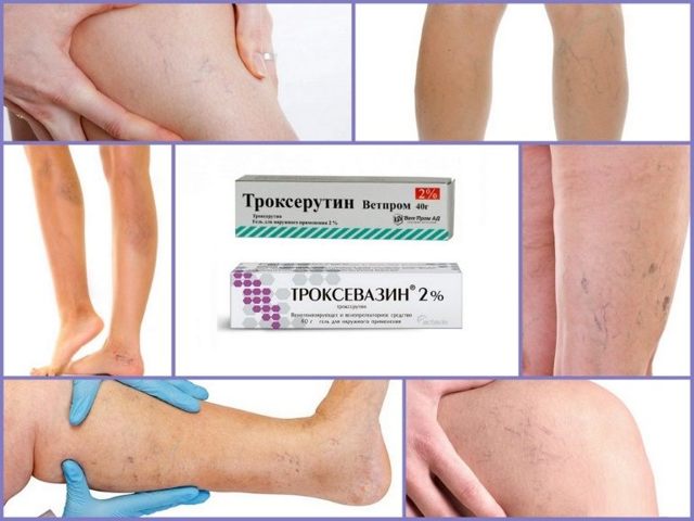 Троксевазин и тромблесс: что лучше и в чем разница (отличие составов, отзывы врачей)