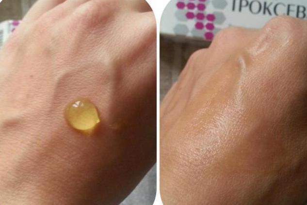 Троксевазин или лиотон: что лучше и в чем разница (отличие составов, отзывы врачей)