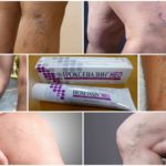 Троксевазин (мазь) при варикозе – инструкция по применению, отзывы, аналоги, форма выпуска, побочные действия, противопоказания, цена