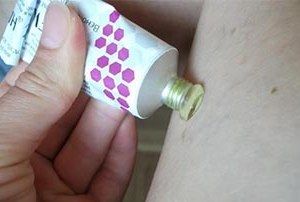 Троксевазин (мазь) при варикозе – инструкция по применению, отзывы, аналоги, форма выпуска, побочные действия, противопоказания, цена