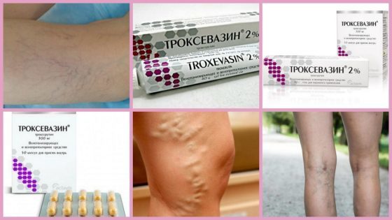 Троксевазин (мазь) при варикозе – инструкция по применению, отзывы, аналоги, форма выпуска, побочные действия, противопоказания, цена