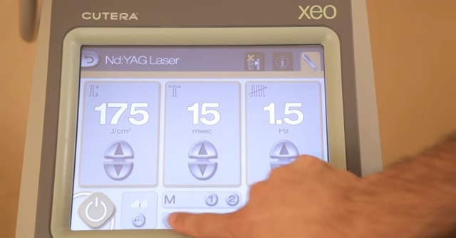 Удаление лазером сосудистых звездочек на лице: преимущества, противопоказания, подготовка к процедуре, восстановление и побочные эффекты