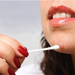 Удаление лазером сосудистых звездочек на лице: преимущества, противопоказания, подготовка к процедуре, восстановление и побочные эффекты