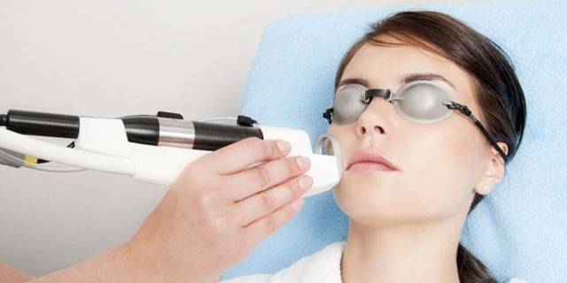 Удаление лазером сосудистых звездочек на лице: преимущества, противопоказания, подготовка к процедуре, восстановление и побочные эффекты