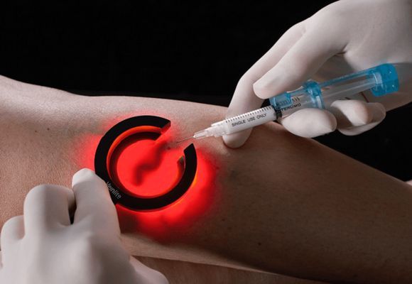 Уколы от варикоза вен на ногах: склеротерапия, трентал, фибро-вейн, инъекции гепарина