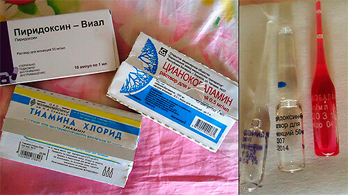 Уколы витаминов в6 и в12