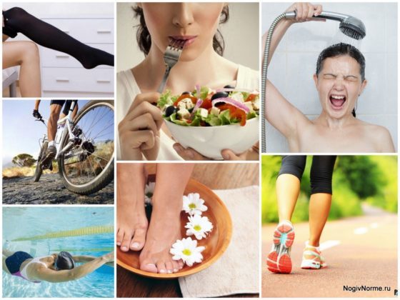 Упражнения при варикозе нижних конечностей: гимнастика, зарядка на работе, лечебная физкультура (лфк)