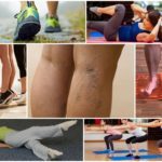 Упражнения при варикозе нижних конечностей: гимнастика, зарядка на работе, лечебная физкультура (лфк)