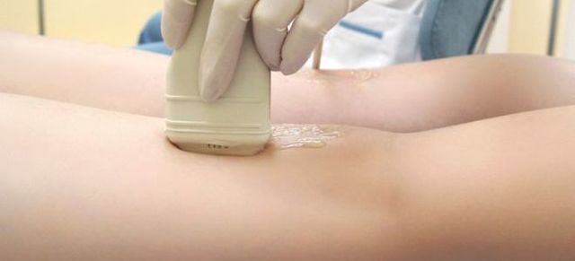 Узи сосудов и вен нижних конечностей: показания и противопоказания, подготовка, как проходит процедура, расшифровка результатов