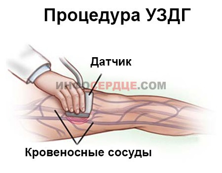 Узи сосудов и вен нижних конечностей: показания и противопоказания, подготовка, как проходит процедура, расшифровка результатов