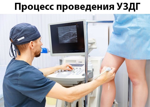 Узи сосудов и вен нижних конечностей: показания и противопоказания, подготовка, как проходит процедура, расшифровка результатов