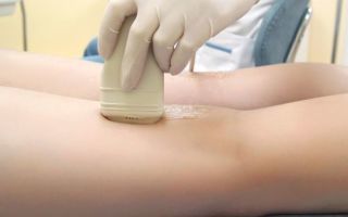 Узи сосудов и вен нижних конечностей: показания и противопоказания, подготовка, как проходит процедура, расшифровка результатов