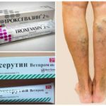 Варикобустер при варикозе – инструкция по применению, отзывы, аналоги, форма выпуска, побочные действия, противопоказания, цена