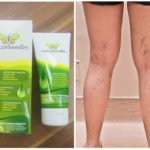 Варикобустер при варикозе – инструкция по применению, отзывы, аналоги, форма выпуска, побочные действия, противопоказания, цена