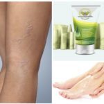 Варикобустер при варикозе – инструкция по применению, отзывы, аналоги, форма выпуска, побочные действия, противопоказания, цена