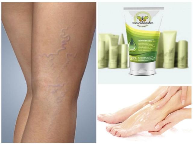 Варикобустер при варикозе – инструкция по применению, отзывы, аналоги, форма выпуска, побочные действия, противопоказания, цена