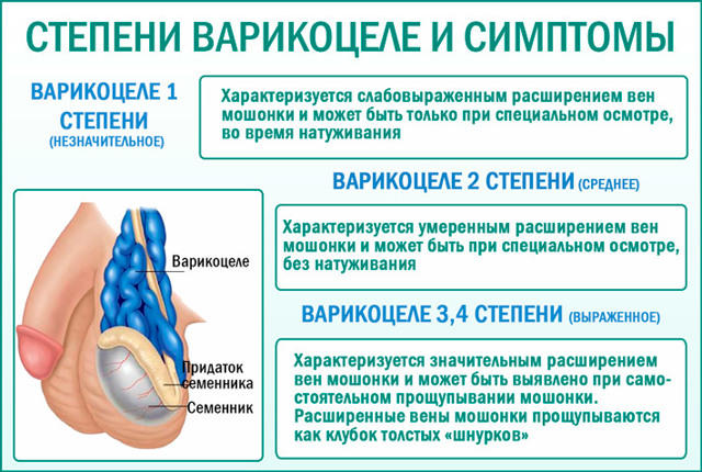 Варикоцеле 2 степени: симптомы, причины, оперативное лечение (осложнения), лечение без операции (медикаменты, народное), профилактика, последствия