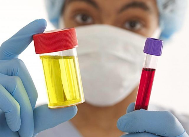 Варикоцеле у детей: стадии, симптомы, причины, диагностика, лечение (хирургическое, народное), осложнения, профилактика