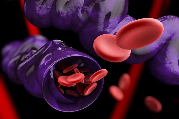 Варикоз глубоких вен нижних конечностей: симптомы, лечение, профилактика и осложнения