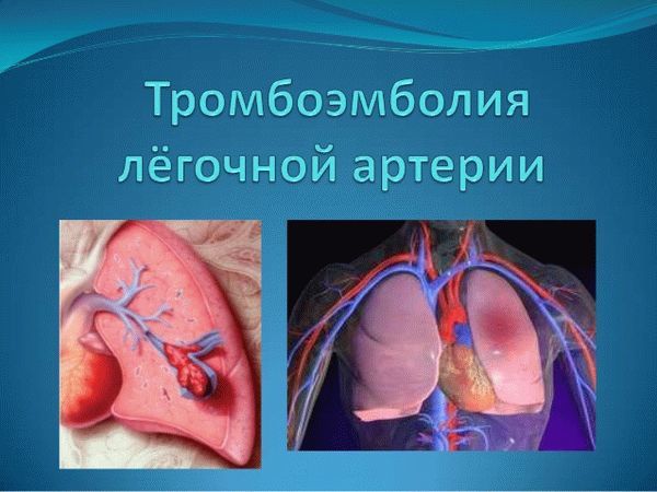 Варикоз глубоких вен нижних конечностей: симптомы, лечение, профилактика и осложнения
