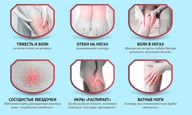 Варикоз на ногах у мужчин: как лечить, симптомы и признаки, чем опасен, профилактика, последствия