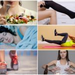 Варикоз на ногах у женщин: причины, симптомы, диагностика, стадии, лечение (медикаментозное, оперативное, народное), профилактика, осложнения