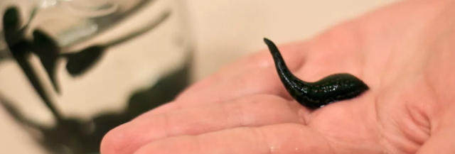 Варикоз на половом члене: причины, симптомы, стадии, диагностика, лечение (медикаменты, хирургия, народные способы), осложнения, профилактика