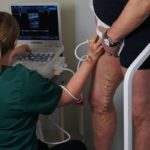 Варикоз половых губ при беременности: симптомы, причины, лечение, осложнения, профилактика, естественный роды при варикозе вен половых губ