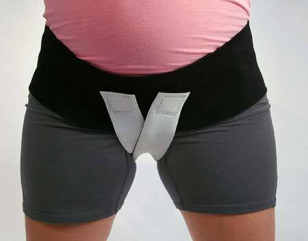 Варикоз влагалища: особенности родов при беременности, симптомы (как выглядит), как лечить