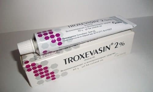 Варикоз влагалища: особенности родов при беременности, симптомы (как выглядит), как лечить