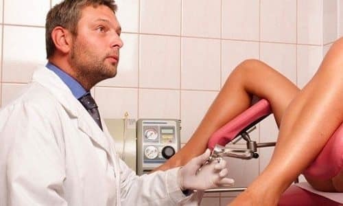 Варикоз влагалища: особенности родов при беременности, симптомы (как выглядит), как лечить