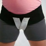 Варикоз влагалища: особенности родов при беременности, симптомы (как выглядит), как лечить