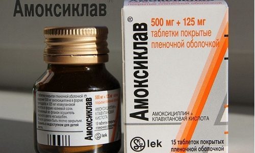 Варикозная экзема: симптомы, причины, лечение (медикаменты, народные средства, физиотерапия), профилактика (диета), последствия