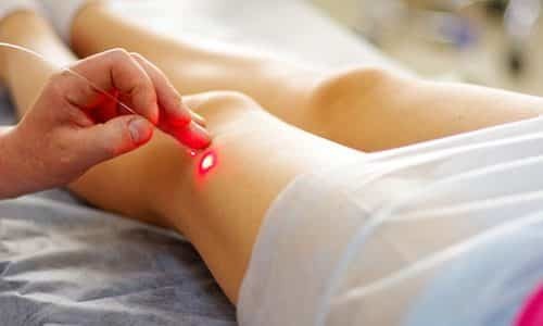 Варикозная экзема: симптомы, причины, лечение (медикаменты, народные средства, физиотерапия), профилактика (диета), последствия