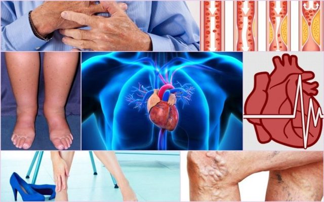 Венолайф (гель) при варикозе – инструкция по применению, отзывы, аналоги, форма выпуска, побочные действия, противопоказания, цена