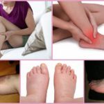 Венолайф (гель) при варикозе – инструкция по применению, отзывы, аналоги, форма выпуска, побочные действия, противопоказания, цена