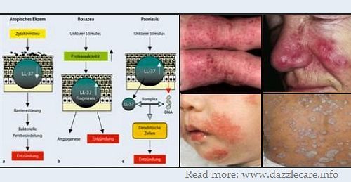 Витамин д для кожи