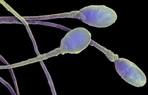 Влияет ли варикоцеле на потенцию: влияние на тестостерон, лечение импотенции, эффект от операции