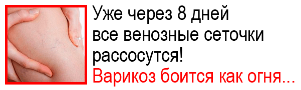 Внутренний варикоз на ногах (скрытый): симптомы и лечение