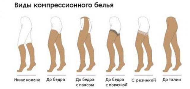 Внутренний варикоз на ногах (скрытый): симптомы и лечение