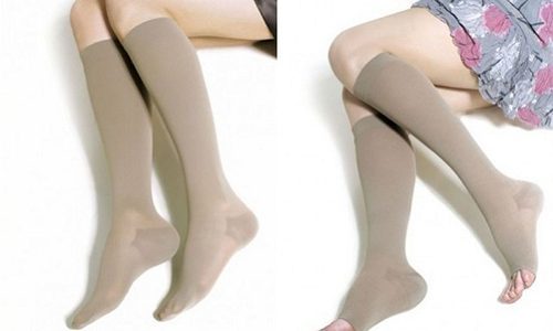 Внутренний варикоз на ногах (скрытый): симптомы и лечение