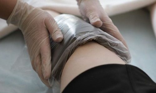 Внутренний варикоз на ногах (скрытый): симптомы и лечение