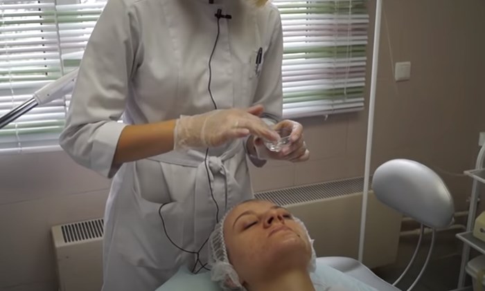 Виды пилинга. Как делают пилинг в Тюмени Пилинг карбоновый