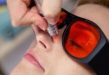 Лечение купероза: основные методы терапии