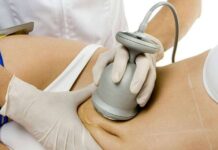 Популярные салонные процедуры для удаления жира с живота