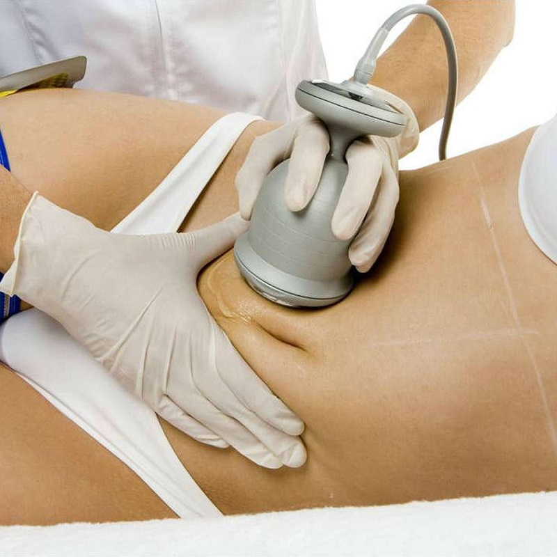 Популярные салонные процедуры для удаления жира с живота