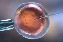 Все, что нужно знать об ЭКО по ОМС